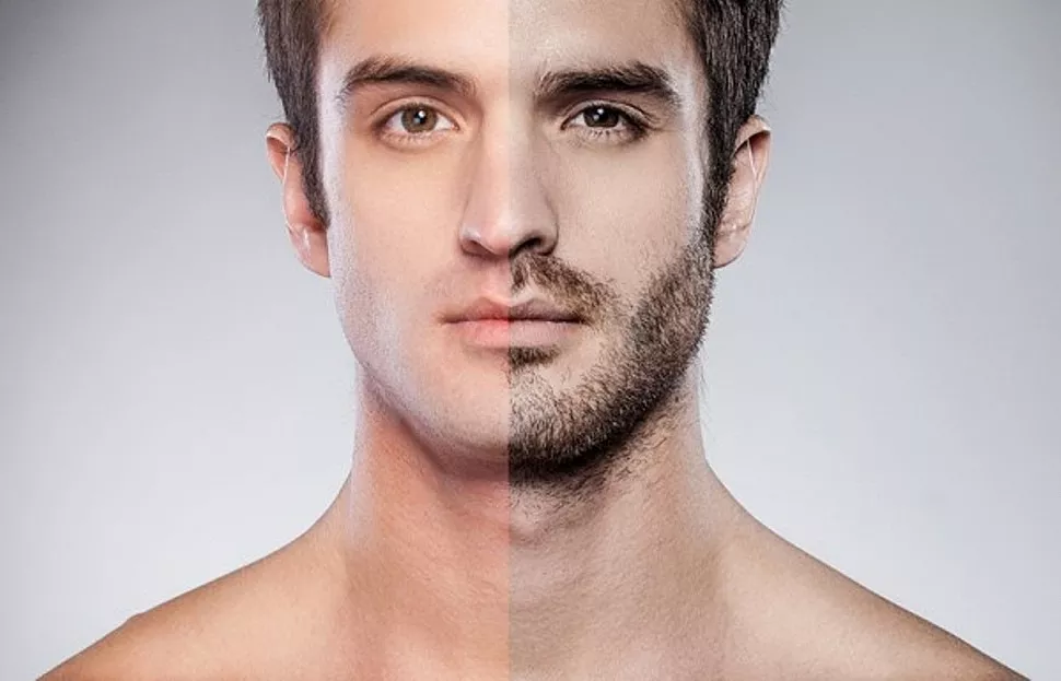 нерівномірно росте борода що робити